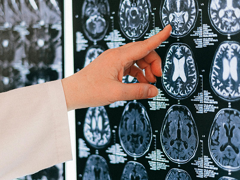 Claves del Abordaje Neurológico